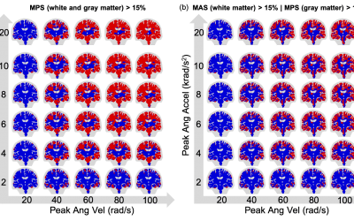 Virtual Brain Injury Study Identifies Key Factors in Potential Nerve-Fiber Damage