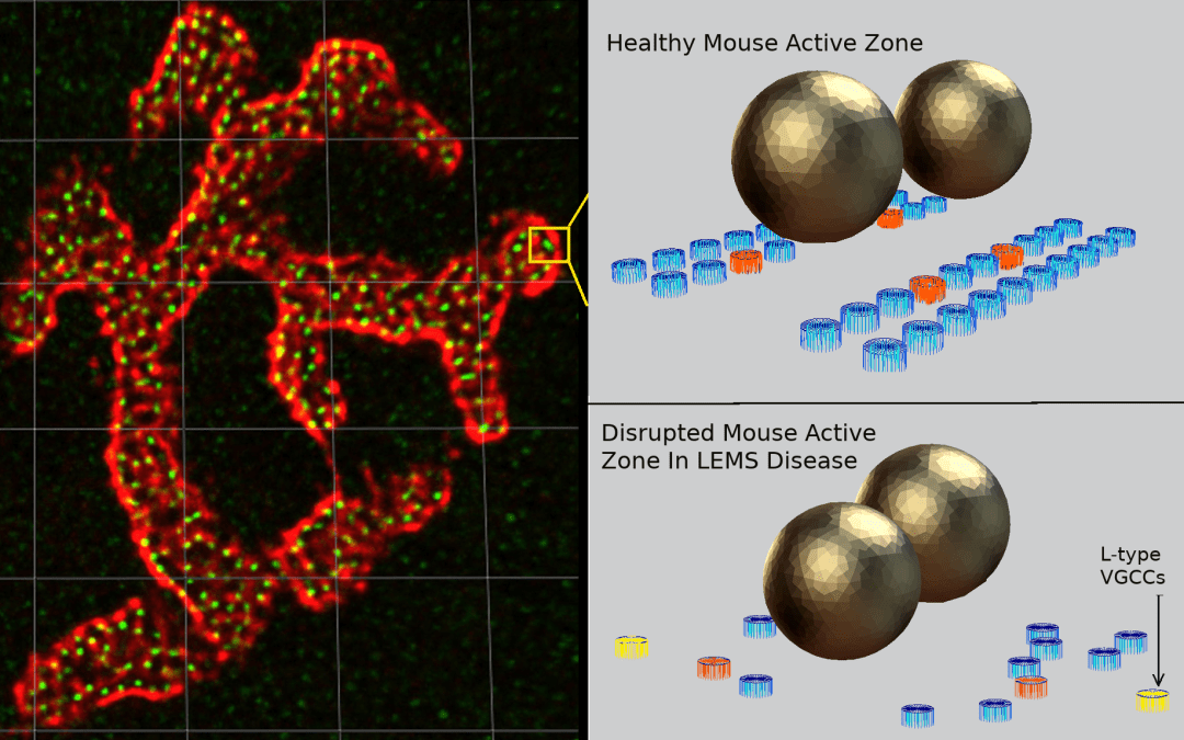 Simulations Suggest that Muscle Disease Cause Is Complex, May Need Multiple Treatments