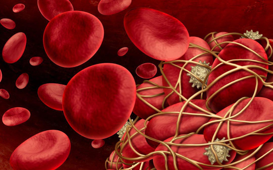 Bridges-2 Simulations Target Role of Red Blood Cells in Clot Formation