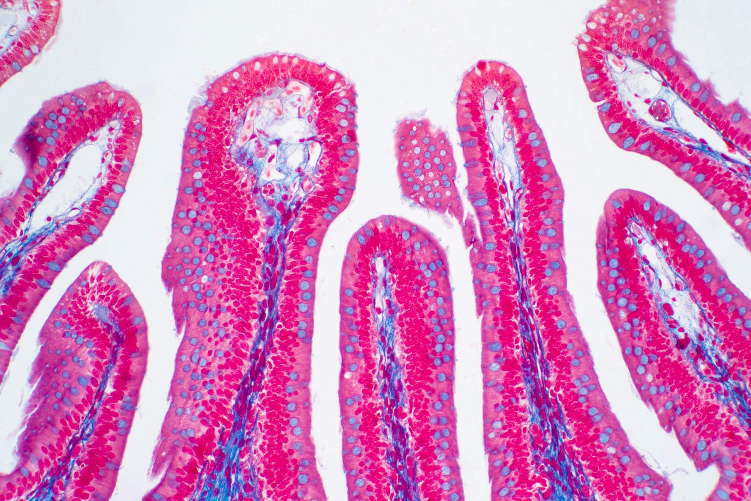 A microscopic image of folds of the large intestine, dyed with bright pink and purple colors revealing the many tiny cells that comprise the structure.